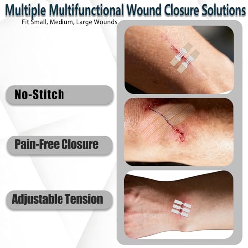 29 Pack Wound Closure Strips, FSA Eligible HSA Items,4 Types Zip Emergency Stitch Butterfly Bandaids Without Suture, Stitchless & Painless Laceration Closure Kit Wound Closures Device