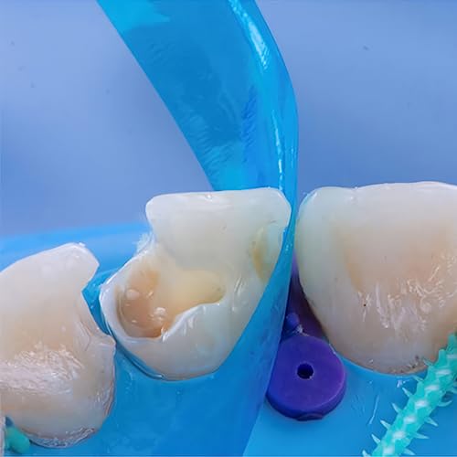 Dental Matrix Bands, Dental Sectional Contoured Matrices Strip Resin Restoration Matrix Band for Anterior Thickness 0.05mm Dentistry Materials