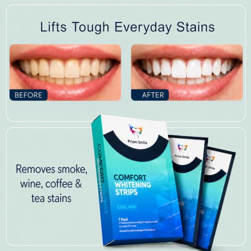6% Hydrogen Peroxide Teeth Whitening Strips - 14 Treatments (28 Strips) - No-Slip Residue-Free - Enamel Safe Zero Sensitivity - Removes Coffee, Tea, Wine & Tobacco Stains - Cool Mint 2 Count