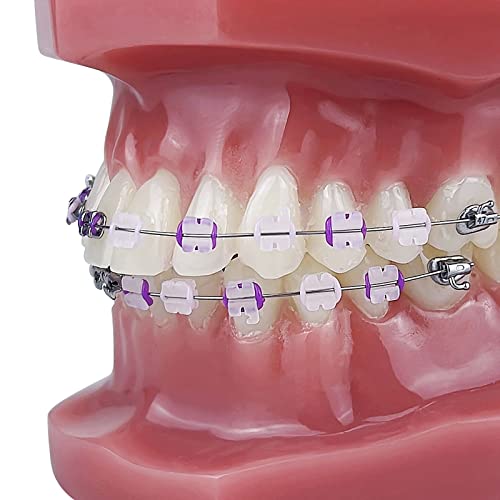 Orthodontic Model, YOUYA DENTAL 1/4 Metal self-Locking Comparison Orthodontic Model Orthodontic Tooth Model Dental Teaching Teeth Model with Metal Braces Bracket for Dentist Teaching Tools to Display 1/4 Metal self-Locking Model