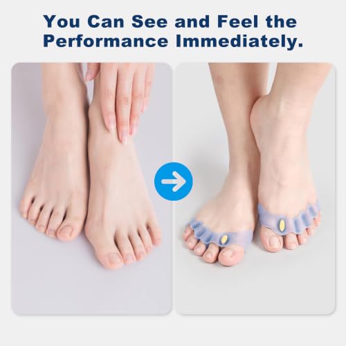 Progressive Big Toe Separators, Gel Bunion Corrector for Hammer & Claw Toe Transparent Blue with hole plug