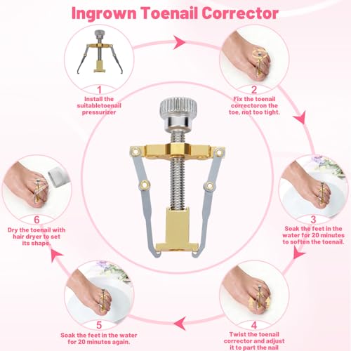Ingrown Toenail Removal Kit Professional Ingrown Toenail Tool Kit with Ingrown Toenail Corrector, Corrector Patches, Toenail Clipper, Tools Stainless Steel Pedicure Tool Set