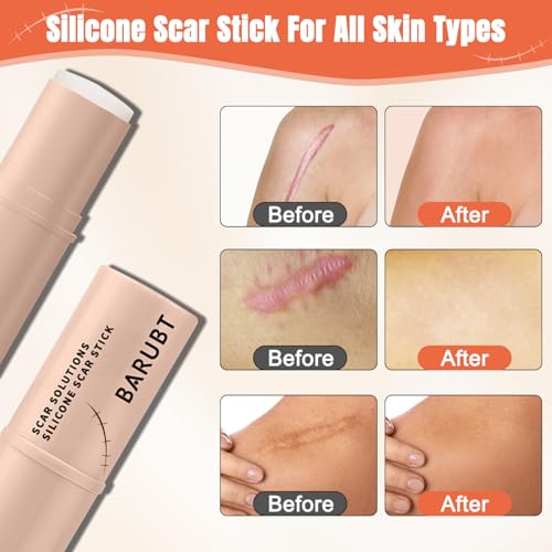 2Pcs Silicone Scar Stick, 60% Scar Solutions for Face and Body Skin, Gentle Ingredients on All Skin Types, Lightweight & Easy to Apply