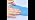 Hand Contracture Cushion with Finger Separators, Soft Hand Positioning Aid