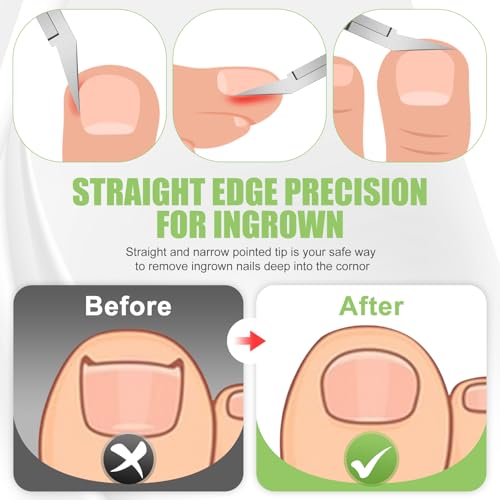 Ingrown Toenail Clippers for Thick Toe Nails, Straight Nail Clippers for Men, Heavy Duty Toe Nail Clippers with Soft Handle, Ultra Sharp Stainless Steel Fingernail Clippers with PU Leather Pouch