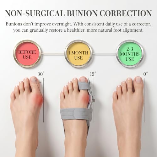 2Pcs Bunion Corrector with Adjustable Knob & 2Pcs Silicone Shoe Inserts for Day Use, Toe Separators for Men Women, Big Toe Straighteners for Hallux Valgus, Overlapping Toes, Hammer Toe Relief, Gray Gray 2 PCs