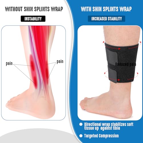 Threlaco 2 Pcs Shin Splint Compression Wrap Adjustable Shin Splints