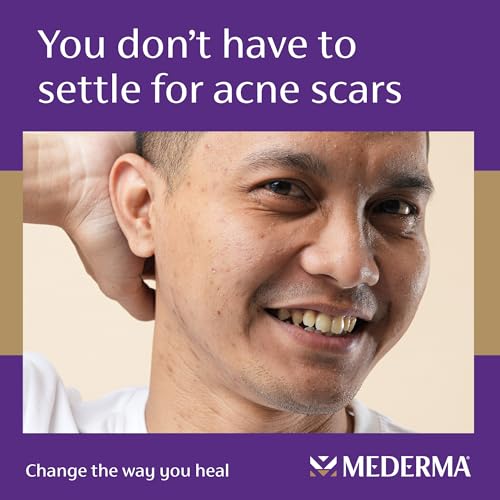 Mederma Acne Scar Serum, Triple-Action Formula with Niacinamide, 1 Fl Oz