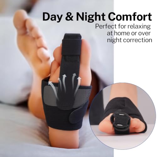 Hammer Toe Corrector for Men & Women, Adjustable Toe Straightener with Touch Fastener & Iron Support Plate, Pain Relief for Curled, Bent, or Overlapping Toes, Fits Most Footwear (Black, 1 Pack)