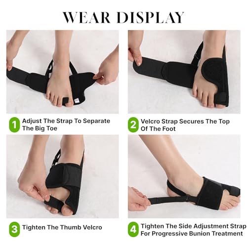 2PCS Bunion Corrector & Bunion Splints for Women & Men, Adjustable Big Toe Separator, Day/Night Orthopedic Support, Non-Surgical Hallux Valgus Relief & Hammer Toe Straightener