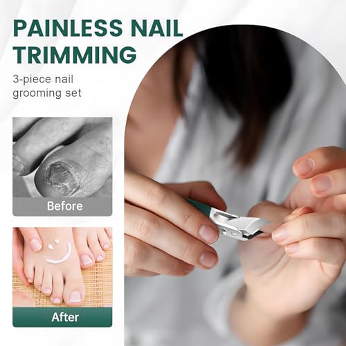 Ingrown Nail Clipper Set,Toenail Clippers for Thick Toenail for Ingrown Toenail Removal Correction Clippers(Green)