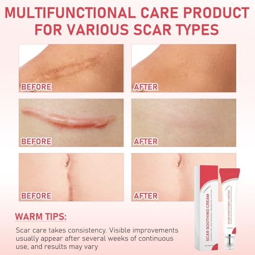 Scar Soothing Cream & Smoothing Cream for Scars,Improve scars （2 PCS）