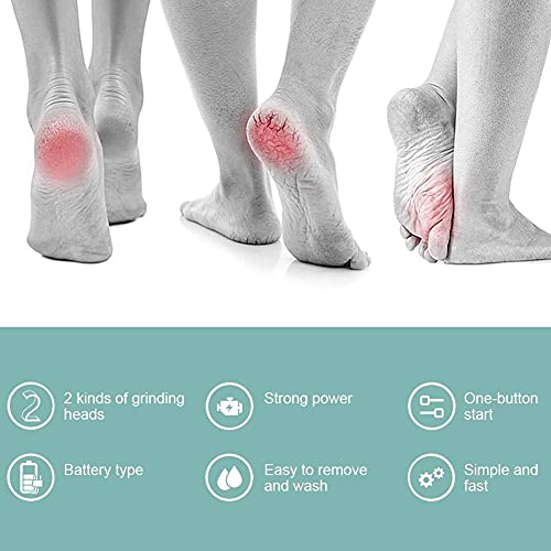 Electric Feet Callus Remover, Battery Operated Foot Grinder Callus Dead Skin Remover Vacuum Foot File Pedicure Tool(White + Blue) - BeesActive Australia