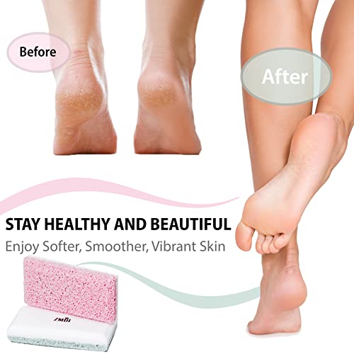 Glass Pumice Stone Callus Remover for Feet, Elbows, Hands, and Knees, Spain Made - 2 in 1 Pedicure Exfoliator and Scrubber for Rough, Hard Skin (Teal Color) Teal - 2 Count ( Pack of 1)