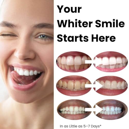 Flexfit™ Prefilled Teeth Whitening Trays - Professional Teeth Whitener with 12% Hydrogen Peroxide, Ready-to-Use Dryfit™ Technology, No-Mess Whitening for Sensitive Teeth