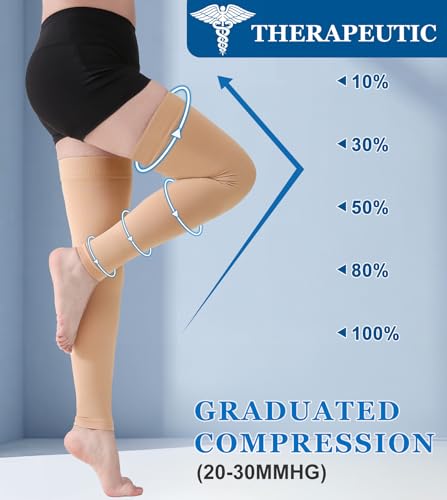 MGANG 20-30mmHg Thigh High Compression Sleeves for Varicose Veins, Edema 20-30mmhg Beige Large (1 Pair)