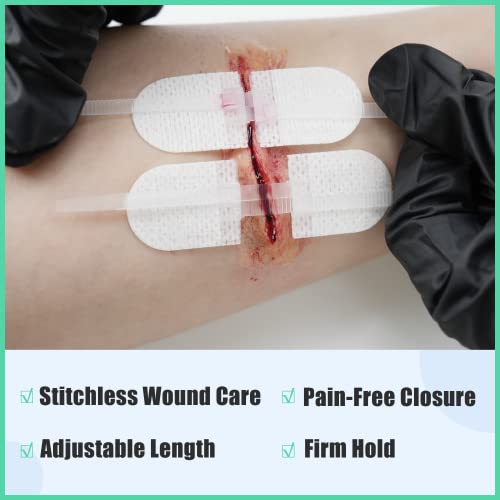 RHINO RESCUE Wound Closure Kit for Small Cuts, Burn Kit for Ⅰ& Ⅱ Degree Burns