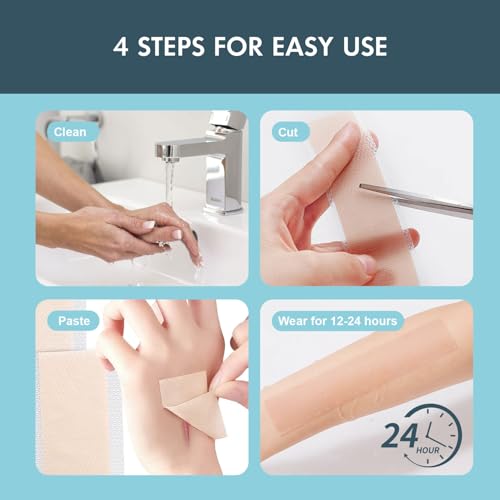 Silicone Scar Sheets, Silicone Scar Tape for Scar Removal Treatment (1.6”x 60” Roll-1.5M), Reusable Silicone Scar Strips for Surgical, C-Section, Tummy Tuck, Keloid Scars, Burn, Acne
