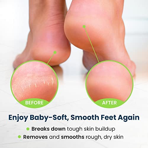Toenail Fungus Treatment Extra Strength - Best nail fungus treatment for fingernails, nail repair, toenail softener with Toenail repair Solution Complete Pedicure Kit