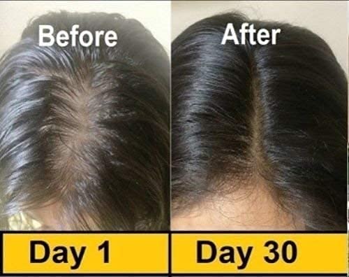 50 Evion Capsules Vitamin E For Glowing Face,Strong Hair,Acne,Nails, Glowing Skin 400mg - BeesActive Australia