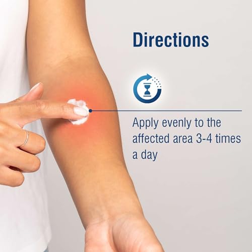 1% Hydrocortisone Cream Maximum Strength - 1 oz of Anti Itch Cream for Itching and Rashes - for Eczema, Poison Plants, Insect Bites, and More 1 Pack