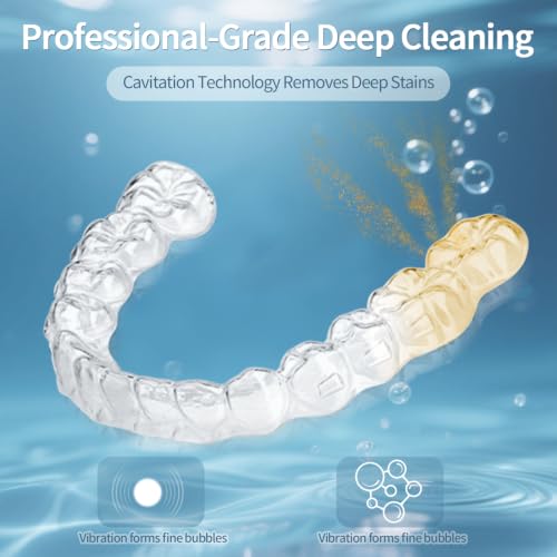 Ultrasonic Retainer Cleaner 48kHz Ultrasonic Cleaner Dental Ultrasonic Retainer Cleaner Machine Dental Cleaning Pod for Denture with Digital Timer, Dual Cleaning Mode for All Dental Appliances (White)