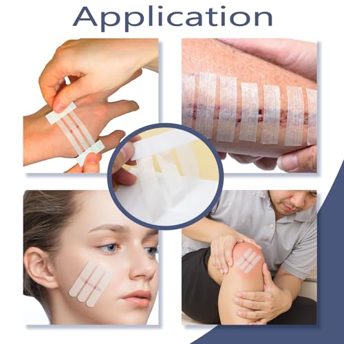 Skin Wound Closures Strips - 30 Pcs Emergency Wound Stitch Tapes, Adhesive Bandages for Closing Small Cuts, Sterile Individual Packaging