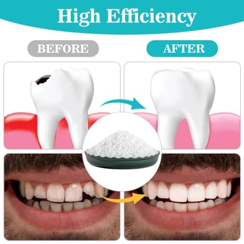 Sukh 10.9oz Moldable False Teeth Beads - Tooth Repair Kit,Repair Thermoplastic Beads,Plastic Pellets for DIY Tooth Filling,Halloween Vampire Teeth Fangs Ideal for Chipped, Cracked