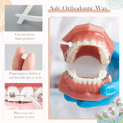 Tondiamo 40 Pack Orthodontic Wax for Braces, Dental Wax, Floral, Fruity
