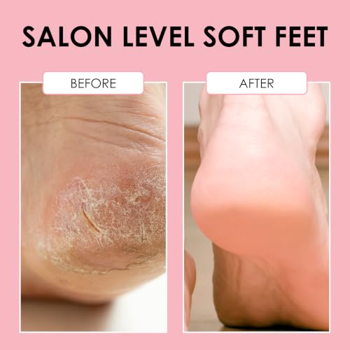 JAPONESQUE Wet Dry Callus Remover Foot File, Pedicure Tool for Removing Calluses and Rough Skin, Foot Scrubber for Heels and Dry Feet