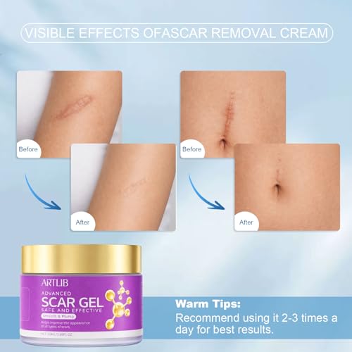Scar Cream,Silicone Scar Gel,Helps Reduce Surgical Scars,Acne,Burn,Keloids Bump,Stretch Marks, Advanced Scar Removal Cream for Old and New Scars(1.69oz) 1.69 Ounce