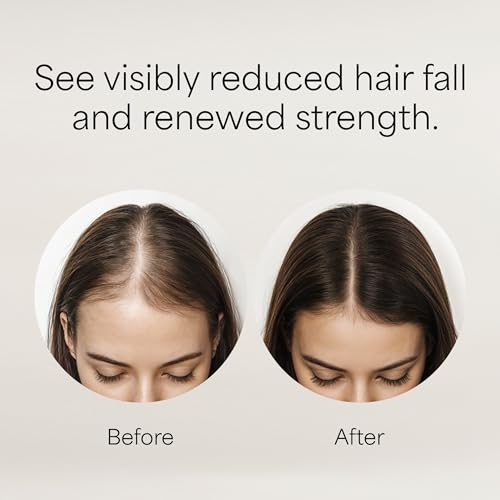 Kismera Hair Loss Control Lotion 4oz