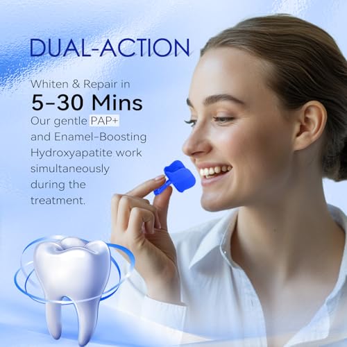 Teeth Whitening Kit - Gel & Mouthpiece Set, Dentist Formulated for Sensitive Teeth