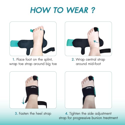 Bunion Corrector for Women, Big Toe Focused – Adjustable Knob Pair, Precision Big Toe Straightener & Separator, Soft Silicone Pads & Shoe Inserts for Females