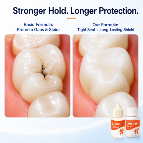 Dental Care Kit: Dental Cement Glue Adhesive for Crowns, Bridges, Teeth Dental Cement Glue Adhesive