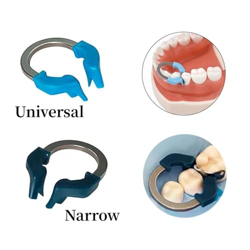 Dental Sectional Matrix System, Dental Sectional Contoured Matrices Refill Matrix Bands, Sectional Contoured Metal Matrices, Nickel Titanium Clamp Ring Resin Holder Clip Ring-Green Ring Green Ring