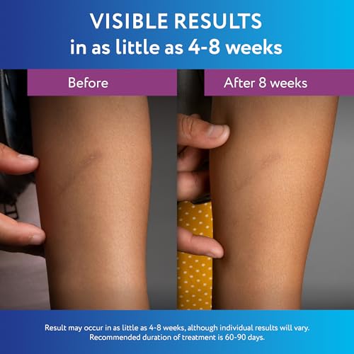 ScarAway Silicone Scar Gel, Helps Improve Size, Color & Texture of Hypertrophic & Keloid Scars from Injury, Burns & Surgery, Water Resistant, 10g (0.35 Oz) 10 Gram (Pack of 1)