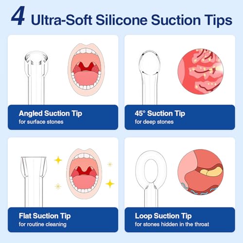 Electronic Tonsil Stone Remover, Visible Tonsil Camera, Tonsil Stone Removal Kit with Camera and Led Light, APP WiFi Connection, Tonsil Stone Vacuum with 5 Level Oral Suction Device