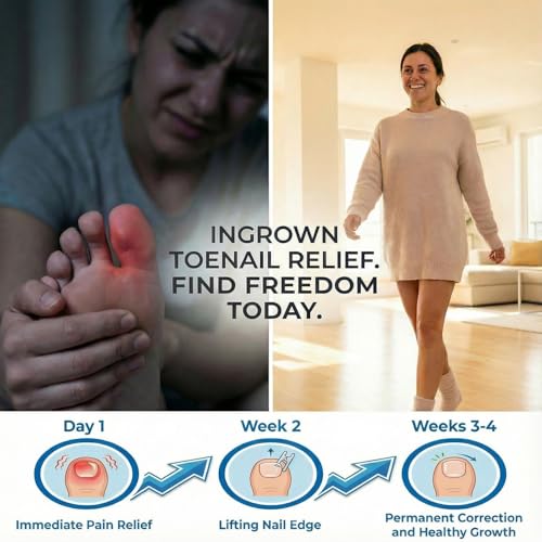 Ingrown Toenail Corrector Kit with File & Lift Tools, Professional Pedicure Care for Ingrown Nails, Toenail Correction Set for Men, Women and Elderly at Home – Complete Toenail Maintenance Tool