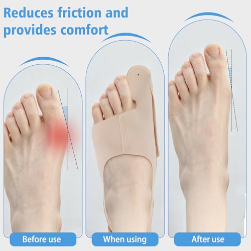 1 Pair Adjustable Bunion Support Sleeve, Unisex Hallux Valgus Foot Care Aid, Wearable Toe Guard in Shoes, Daily and Night Use (Large) Large