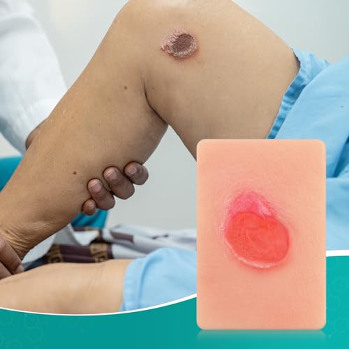 Pressure Ulcer Wound Model Stage 4 Pocket Size