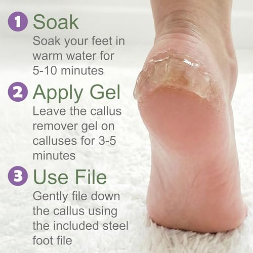 Foot Callus Remover Gel & File, Extra Strength Callus Remover for Feet 4 oz 4 oz Gel Steel File