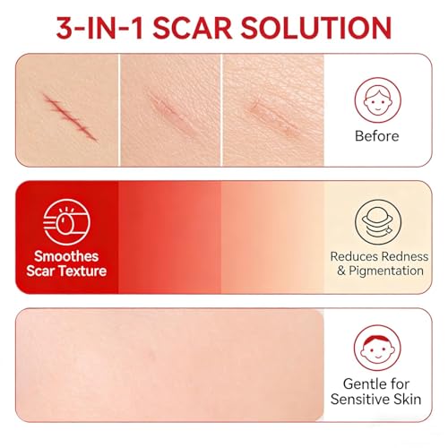 Scar Soothing Cream & Smoothing Cream for Scars - Gentle Care for Sensitive Skin, Helps Improve Appearance of Scars, Reduces Redness, Lightweight Non-Greasy Formula