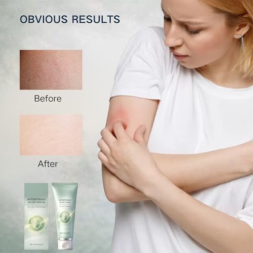 2Pcs Intertrigo Cream for Relief and Treatment, Skin Fold Care, Soothe Irritated Skin and Reduce Friction, Chafing Support Cream for Skin Fold Areas, Fast-Drying Non-Greasy Formula for Skin Comfort