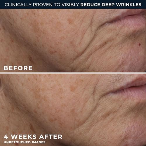 RoC Deep Wrinkle Rich Cream, Daily Anti-Aging Firming Cream, fragrance-free