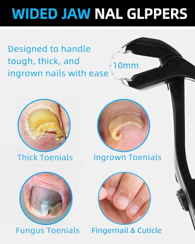 Long Handled Toenail Clippers for Seniors Thick Toenails, Angled Head Large Nail Clippers for Men, Heavy Duty Professional Toe Nail Clippers for Thick Nails 3PCS Toenail Clippers Set
