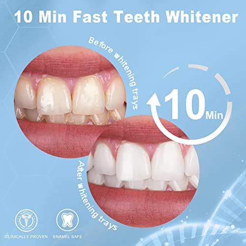 MySmile 1Pcs 28LED Teeth Whitening LED Light - 3 Pcs Teeth Whitening Gel - 2Pcs Tooth Whitening Pen - 10 Min Non-Sensitive Fast Teeth Whitener - Restores Your Gleaming White Smile