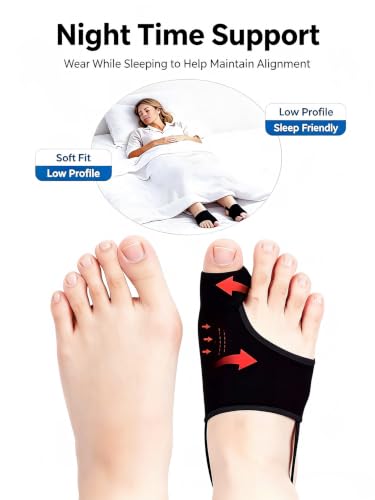 2PCS Bunion Corrector for Women & Men, Comfort Hallux Valgus Toe Straightener Sleeve, Breathable Big Toe Support Splint for Sleeping & All Day Wear