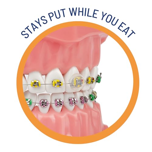 OrthoDots CLEAR – 24-Hour Protection | Sticks Better than Dental Wax | Moisture Activated Braces Wax Alternative for Pain Caused by Braces, Clear Aligner Trays, and Other Orthodontic Appliances 12 Count (Pack of 4)