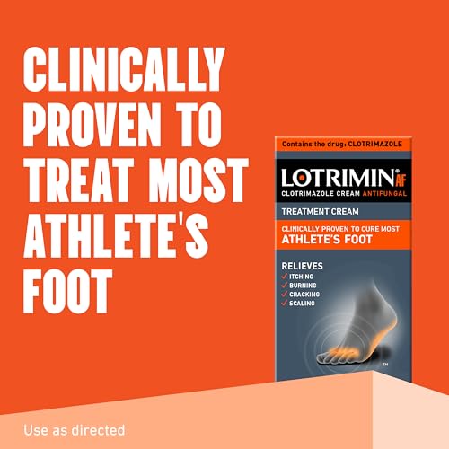 Lotrimin AF Cream for Athlete's Foot, Clotrimazole 1% Antifungal Treatment, Clinically Proven Effective Antifungal Treatment of Most AF, Jock Itch and Ringworm, Cream, .53 Ounce (15 Grams) 15 g